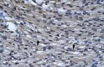 CLIC5 Polyclonal Antibody
