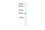 CLIC5 Antibody in Western Blot (WB)
