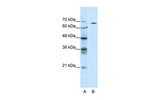 GABRQ Polyclonal Antibody