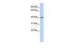 Kir5.1 (KCNJ16) Polyclonal Antibody