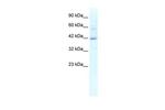 KCTD10 Polyclonal Antibody