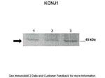 Kir1.1 (KCNJ1) Polyclonal Antibody