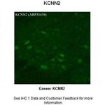 KCNN2 Polyclonal Antibody