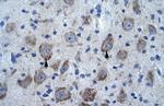 KCTD13 Polyclonal Antibody