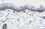 NUDT9 Polyclonal Antibody
