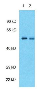 GABRG2 Polyclonal Antibody