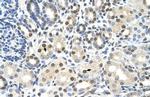 CACNB1 Polyclonal Antibody