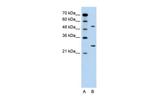 CACNB1 Antibody in Western Blot (WB)