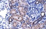 ZNF84 Polyclonal Antibody