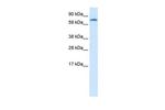 ZNF84 Antibody in Western Blot (WB)