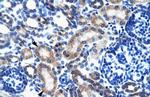 ONECUT2 Polyclonal Antibody