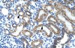 L-Myc Polyclonal Antibody