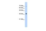 ZRANB2 Antibody in Western Blot (WB)