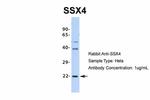 SSX4 Antibody in Western Blot (WB)