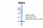 SSX4 Antibody in Western Blot (WB)