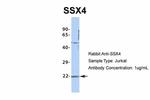 SSX4 Antibody in Western Blot (WB)