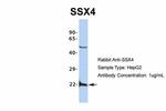 SSX4 Antibody in Western Blot (WB)
