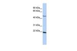 SSX4 Antibody in Western Blot (WB)
