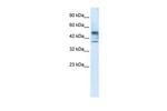 CHST4 Antibody in Western Blot (WB)