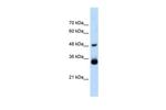 HOXC9 Antibody in Western Blot (WB)