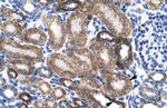 ZNF75D Polyclonal Antibody