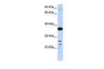 VSX1 Polyclonal Antibody