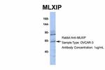 MLXIP Antibody in Western Blot (WB)