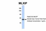 MLXIP Antibody in Western Blot (WB)