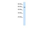 ZNF12 Antibody in Western Blot (WB)