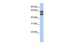 ZNF331 Polyclonal Antibody