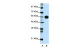 ZSCAN5 Polyclonal Antibody