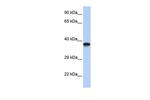 DMRTC2 Polyclonal Antibody