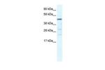 HSFY1 Polyclonal Antibody