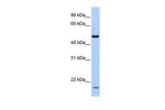 ZNF764 Antibody in Western Blot (WB)