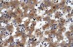 ZNF551 Antibody in Immunohistochemistry (IHC)