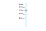 ZNF551 Antibody in Western Blot (WB)