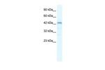 SP140L Polyclonal Antibody