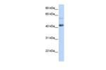 PRDM15 Antibody in Western Blot (WB)