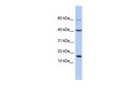 ATOH7 Polyclonal Antibody