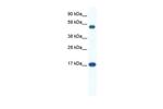 ZNF554 Antibody in Western Blot (WB)