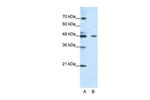 ZNF645 Polyclonal Antibody
