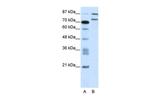 ZNF709 Antibody in Western Blot (WB)