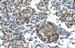 ZNF555 Antibody in Immunohistochemistry (IHC)