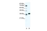 ESX1 Polyclonal Antibody