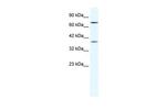 ZNF660 Antibody in Western Blot (WB)