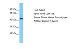 ZNF735 Polyclonal Antibody