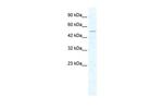 CHD1L Polyclonal Antibody