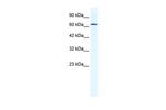 DDX21 Polyclonal Antibody