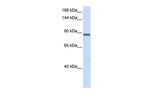 INTS6 Polyclonal Antibody