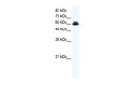 DDX27 Polyclonal Antibody